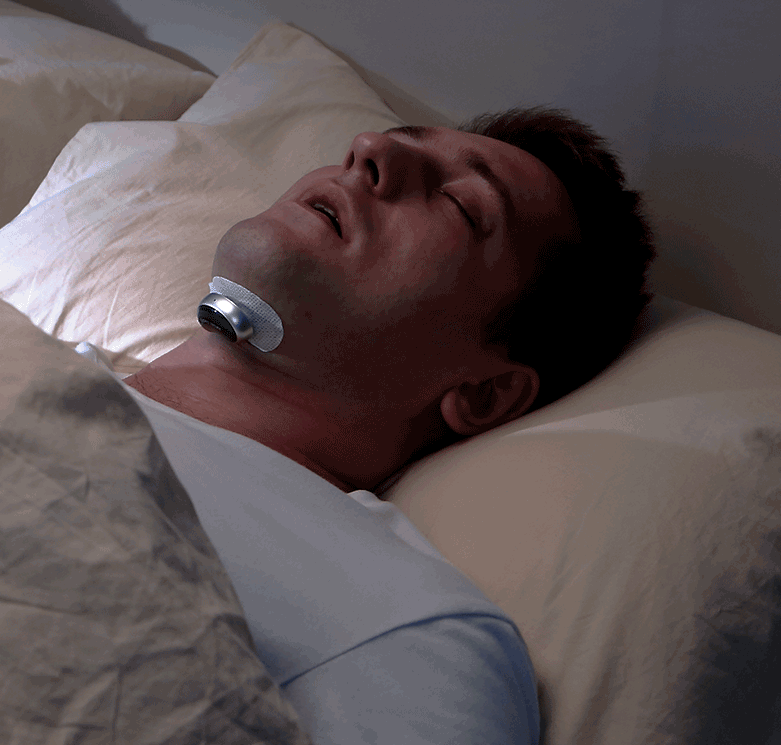 AI-Assisted Anti Snoring Device